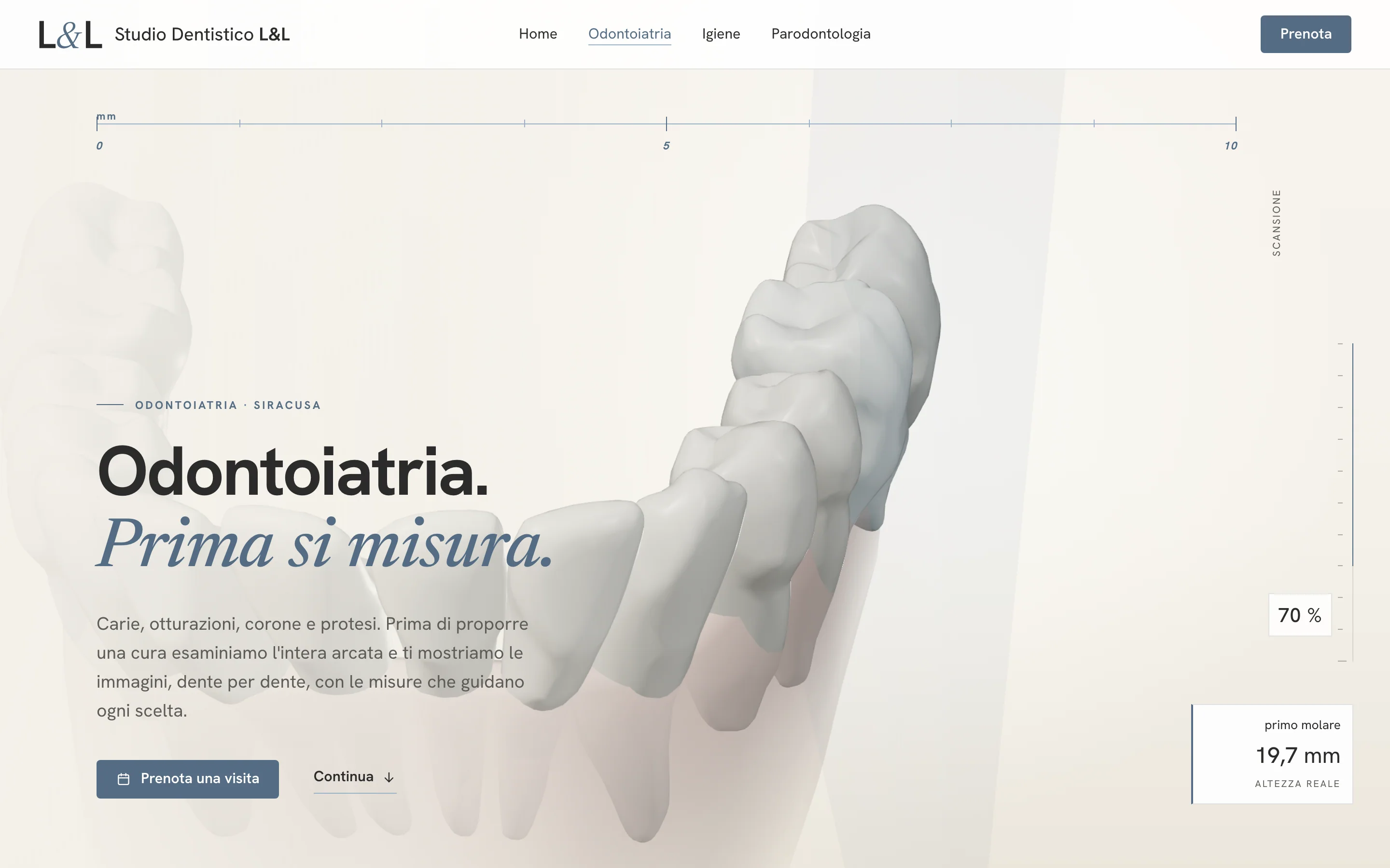 Pagina dell'odontoiatria: il piano di scansione sul primo molare, alto 19,7 millimetri